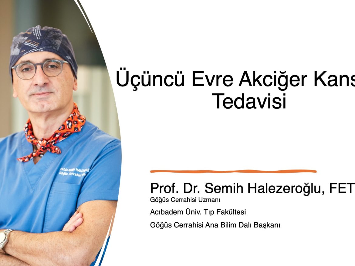 Akciğer kanseri tedavisi en iyi nerede yapılır?